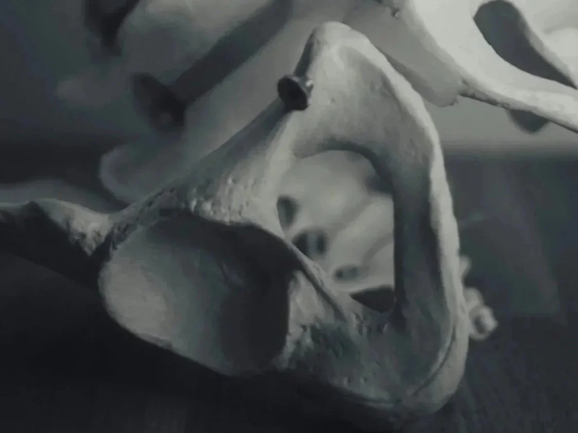 Pelvic anatomy showing ischial tuberosity sit bone where proximal hamstring tendon attaches