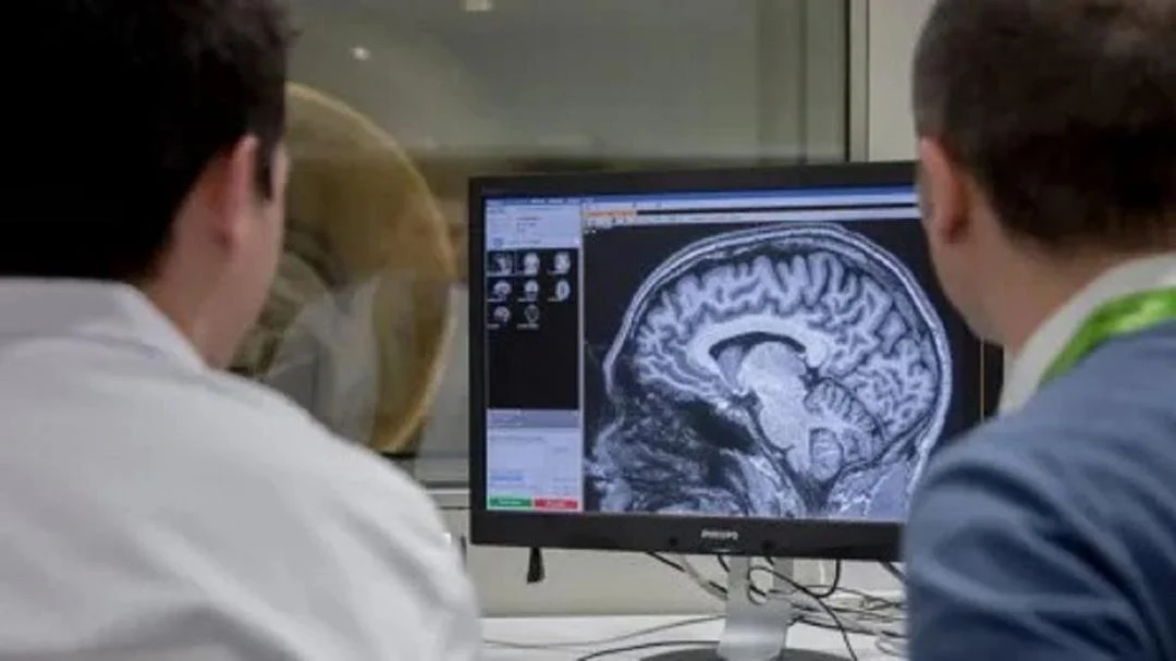 Alzheimer: el medicamento aclamado como un avance trascendental en la lucha contra la enfermedad