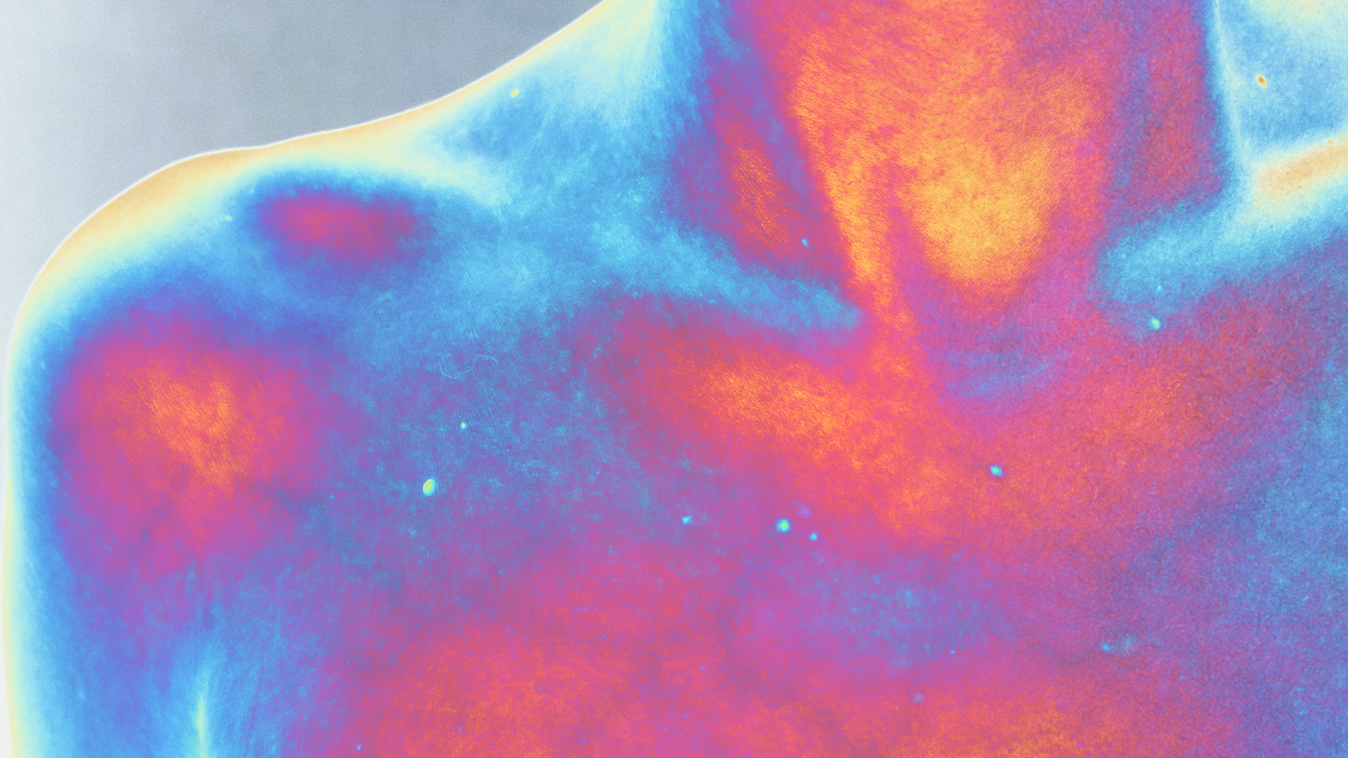 Body Scanners Are Not X-Ray Machines