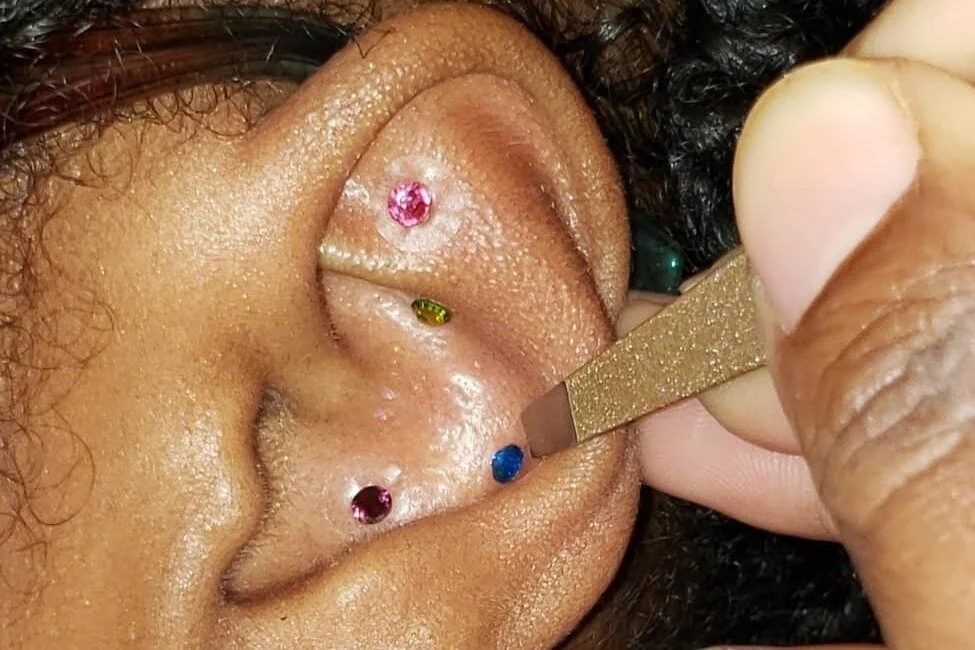 The #getSHARP Ear Seed Project: Implementing TCM for resiliency