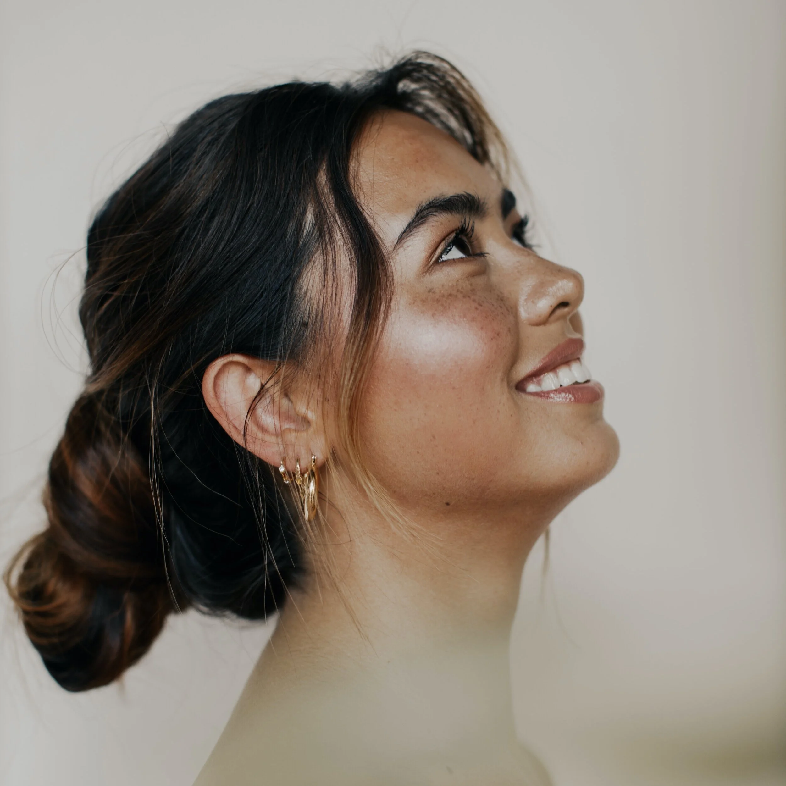 Client enrolled in Face Reality Clear Skin Method at The Skyn Distillery in Wayzata, MN for acne treatment.