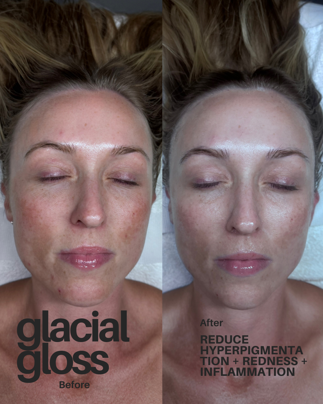 glacial_gloss_facial_skin_barrier_repair.png