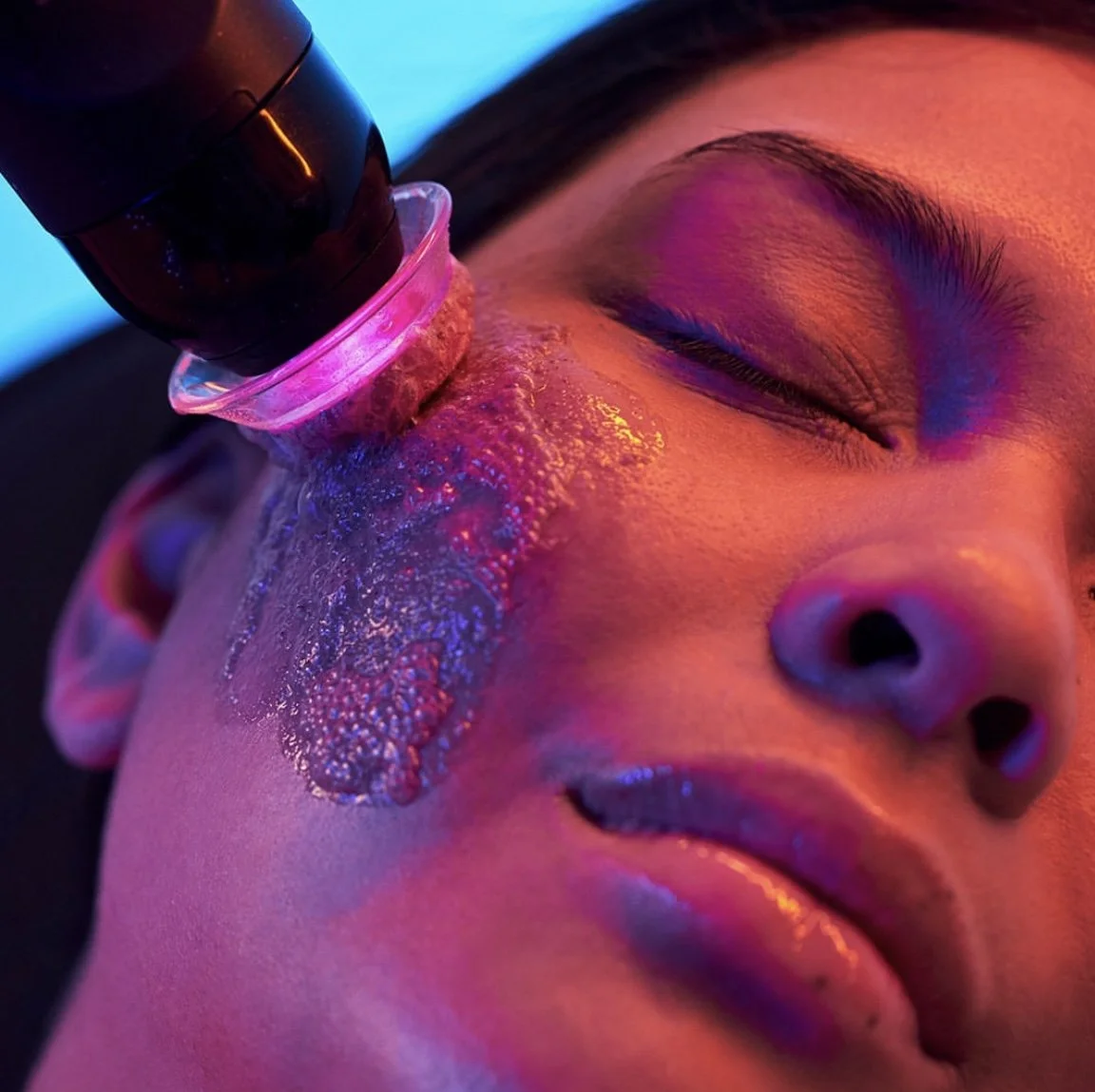 Minnesota brides love the Glo2Facial for instant glow before engagement photos, bridal showers, and wedding day. This oxygen facial boosts hydration, smooths texture, and lifts skin naturally — perfect for achieving luminous, makeup-ready skin.