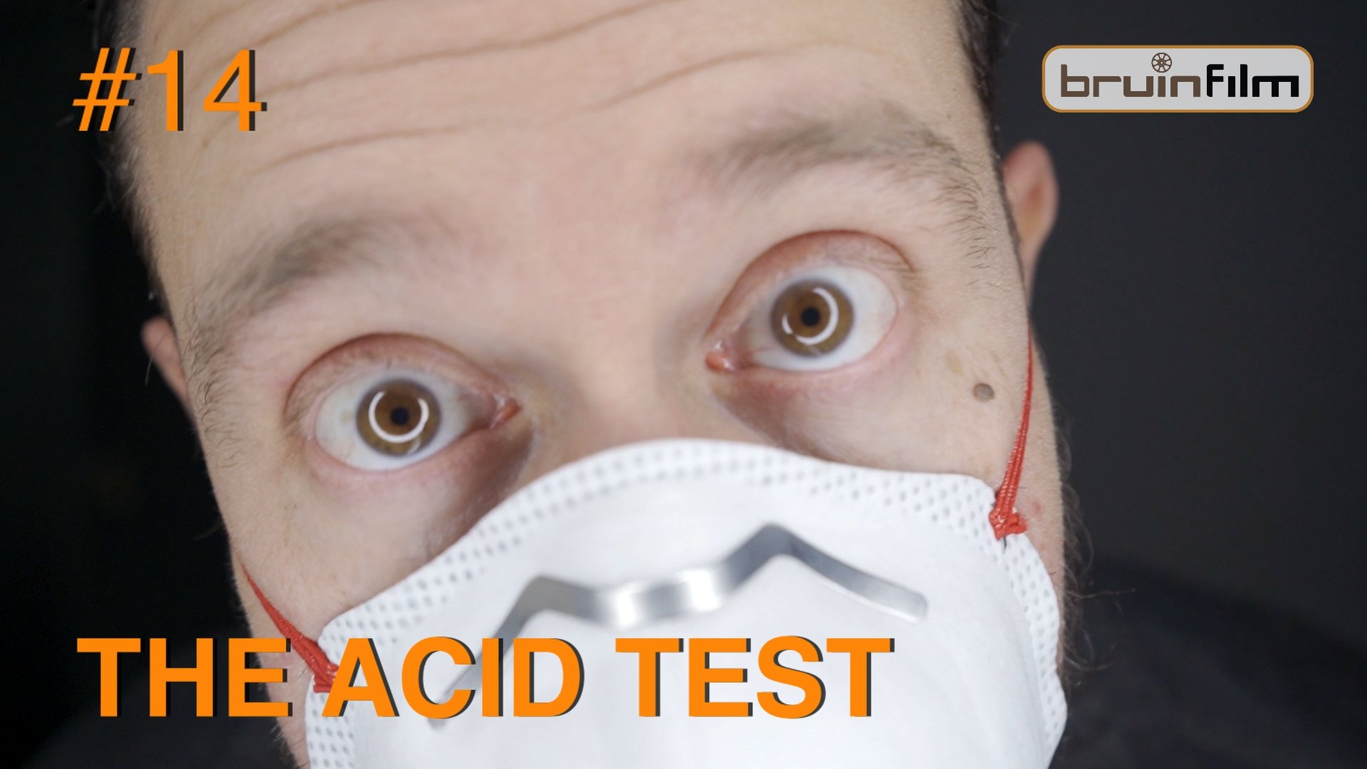 #14 Vinegar Syndrome