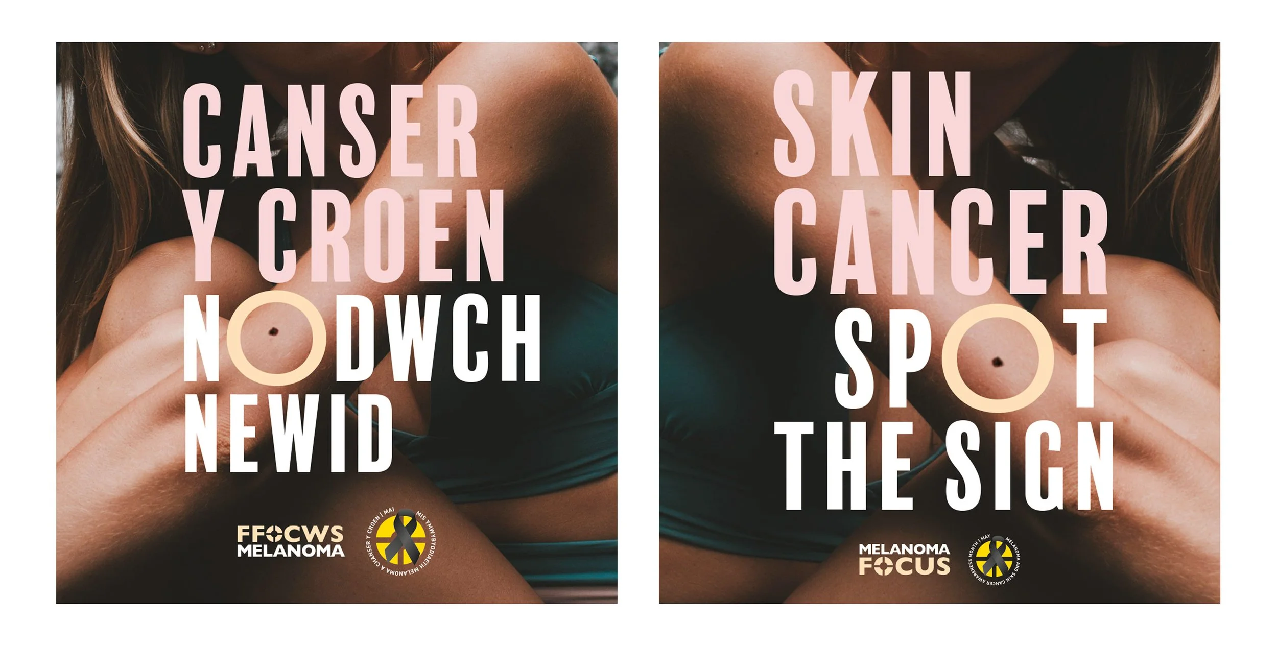 Melanoma Focus Digital Asset Design