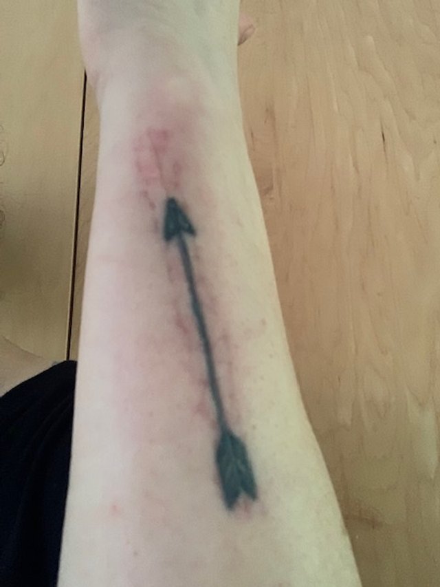 Let’s Talk about Scars!