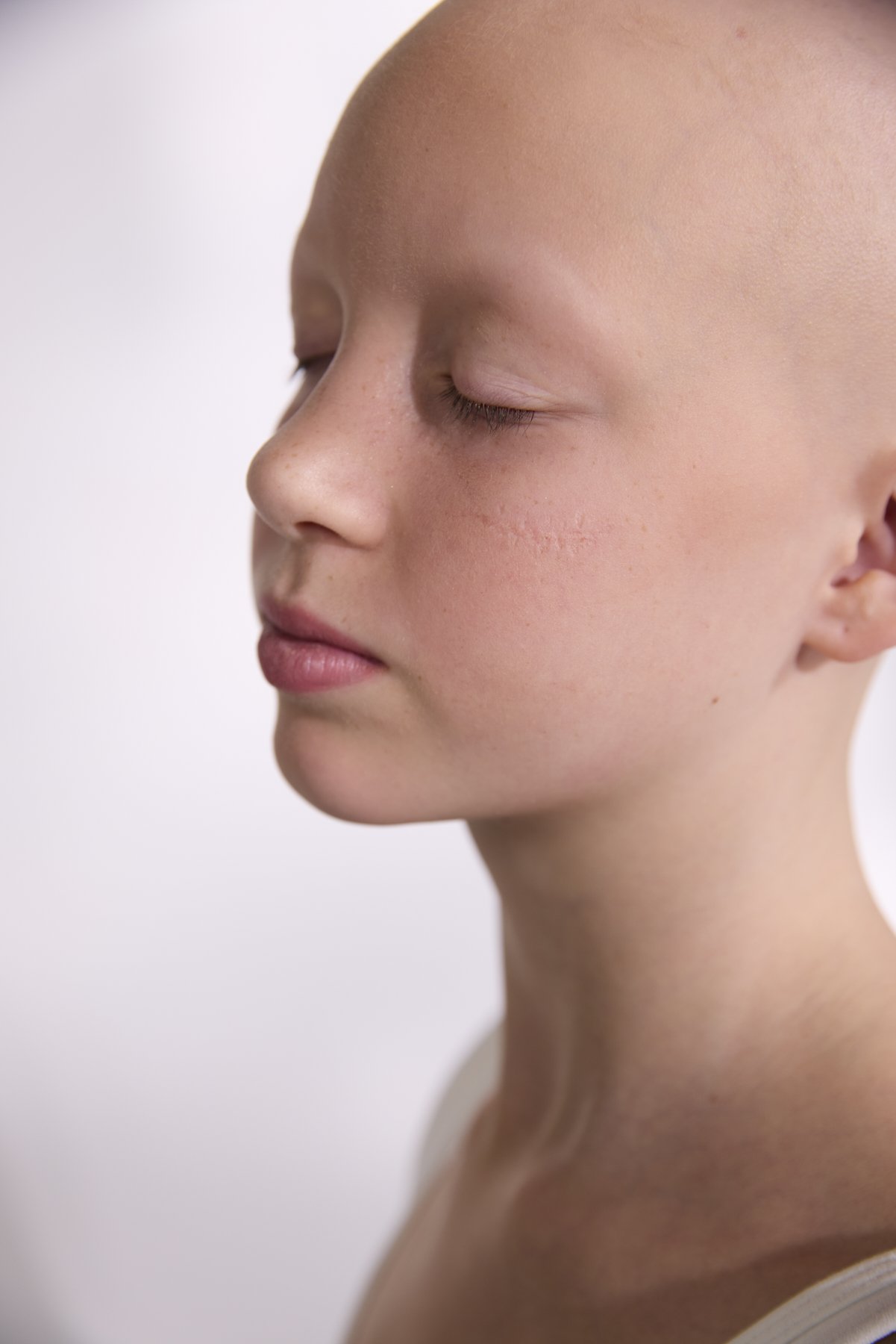 AlopeciaAwareness_23592Photographer_Vancouver.jpg