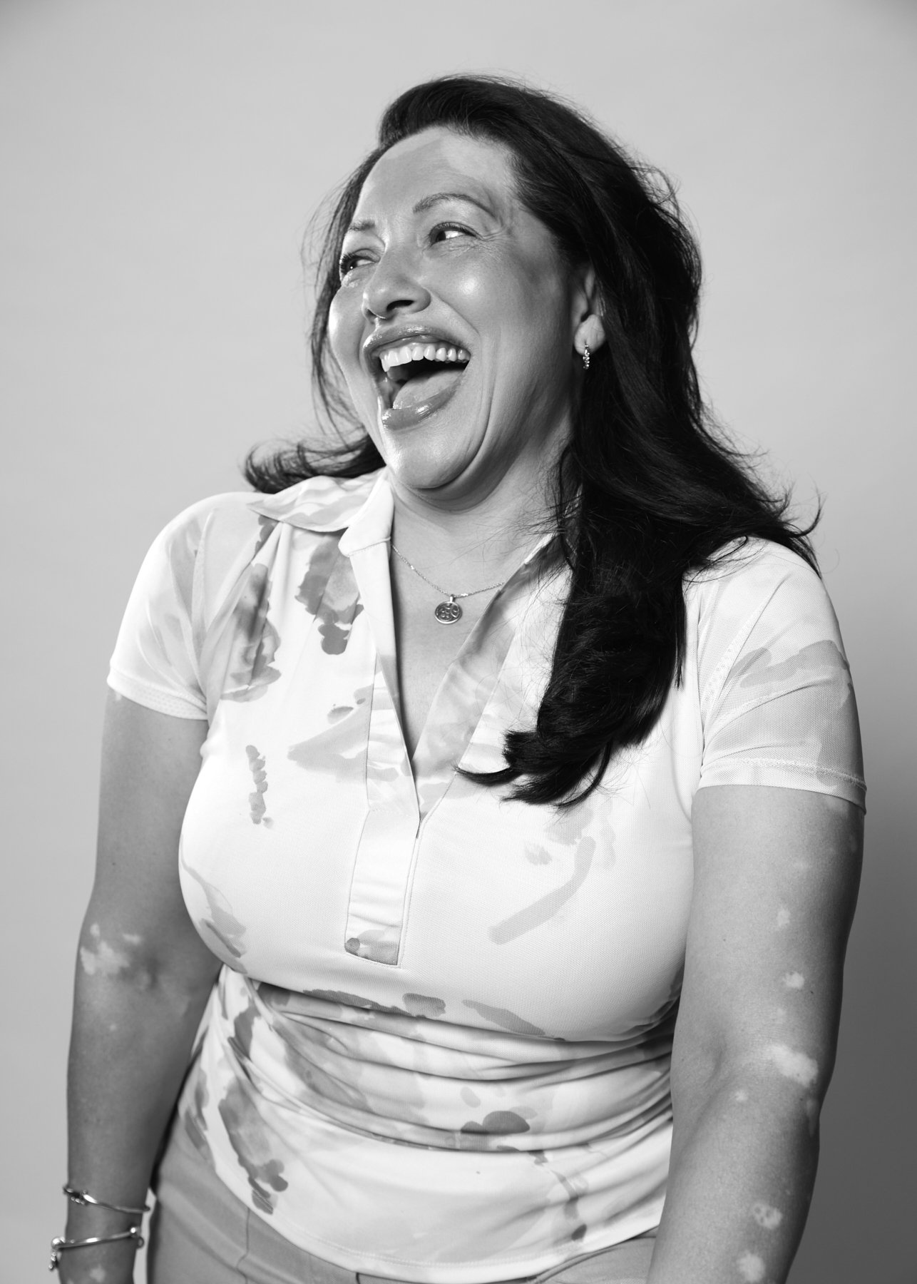 VitiligoConference_TillyNelson_269_PortraitPhotographer_Vancouver.jpg