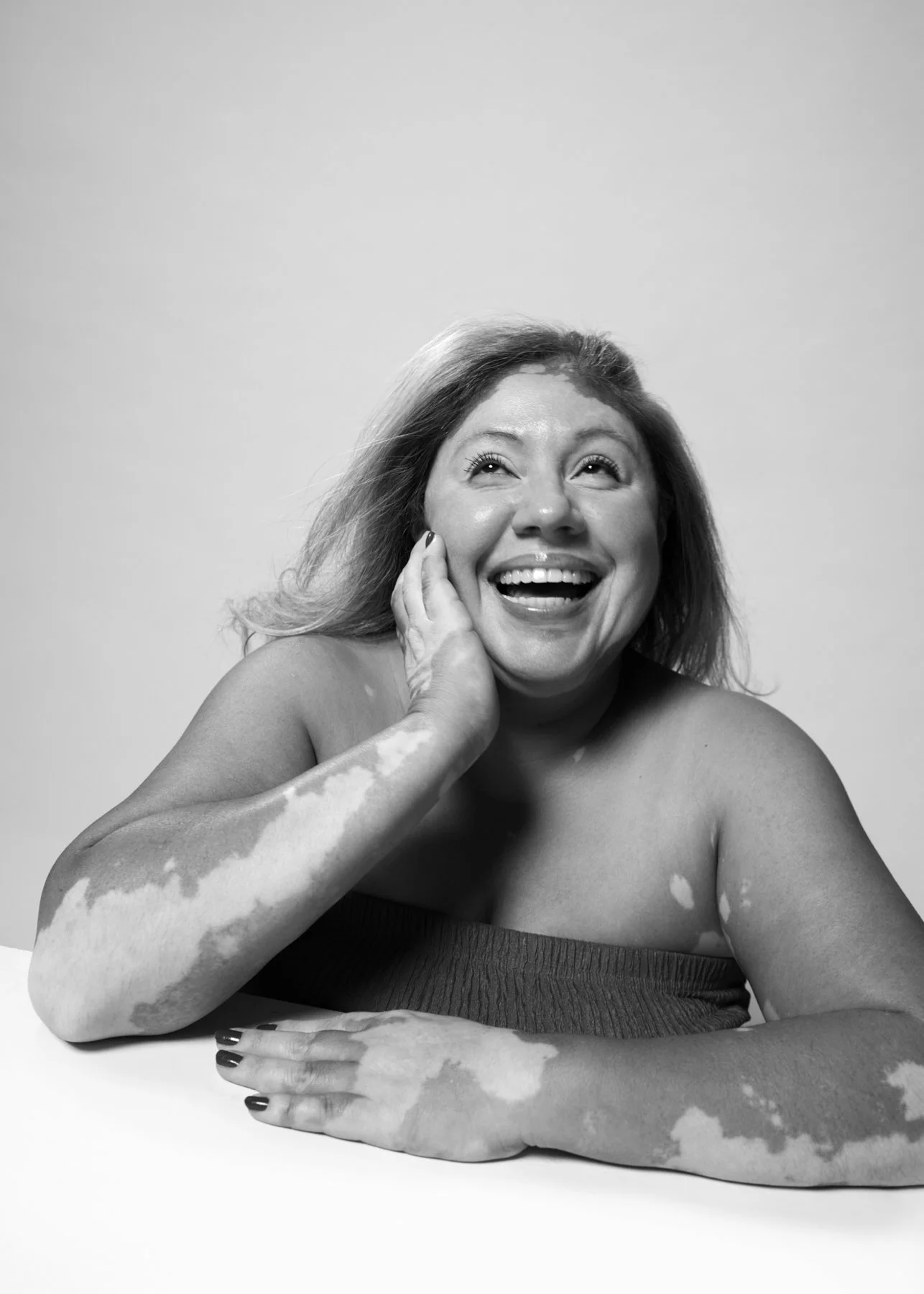 VitiligoConference_TillyNelson_494_PortraitPhotographer_Vancouver.jpg