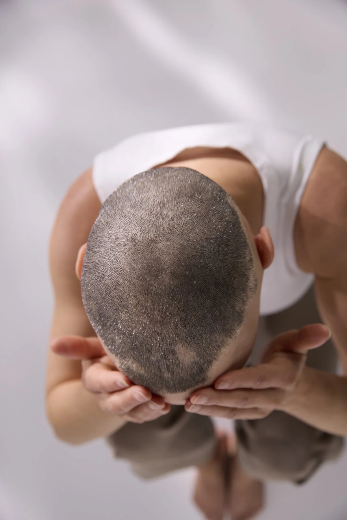 AlopeciaAwareness_23129Photographer_Vancouver.jpg