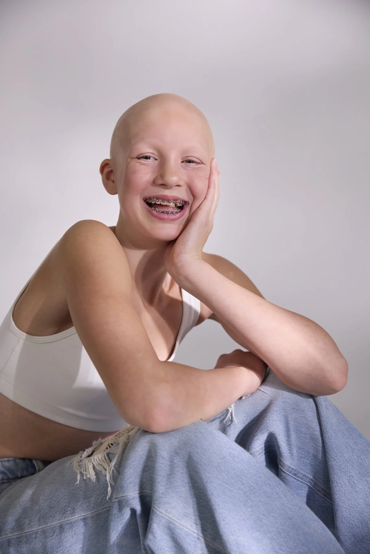 AlopeciaAwareness_23561Photographer_Vancouver.jpg