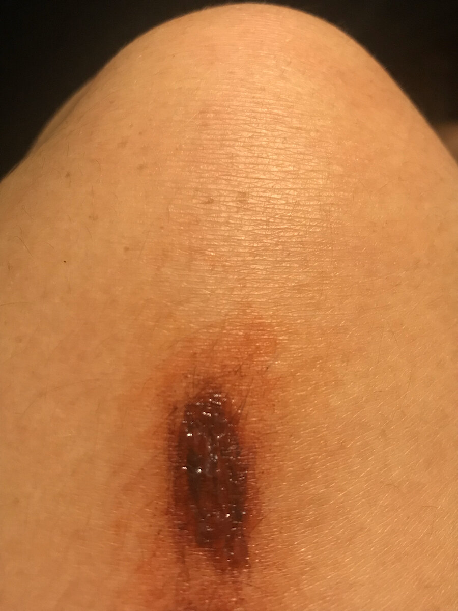 Bullet Graze