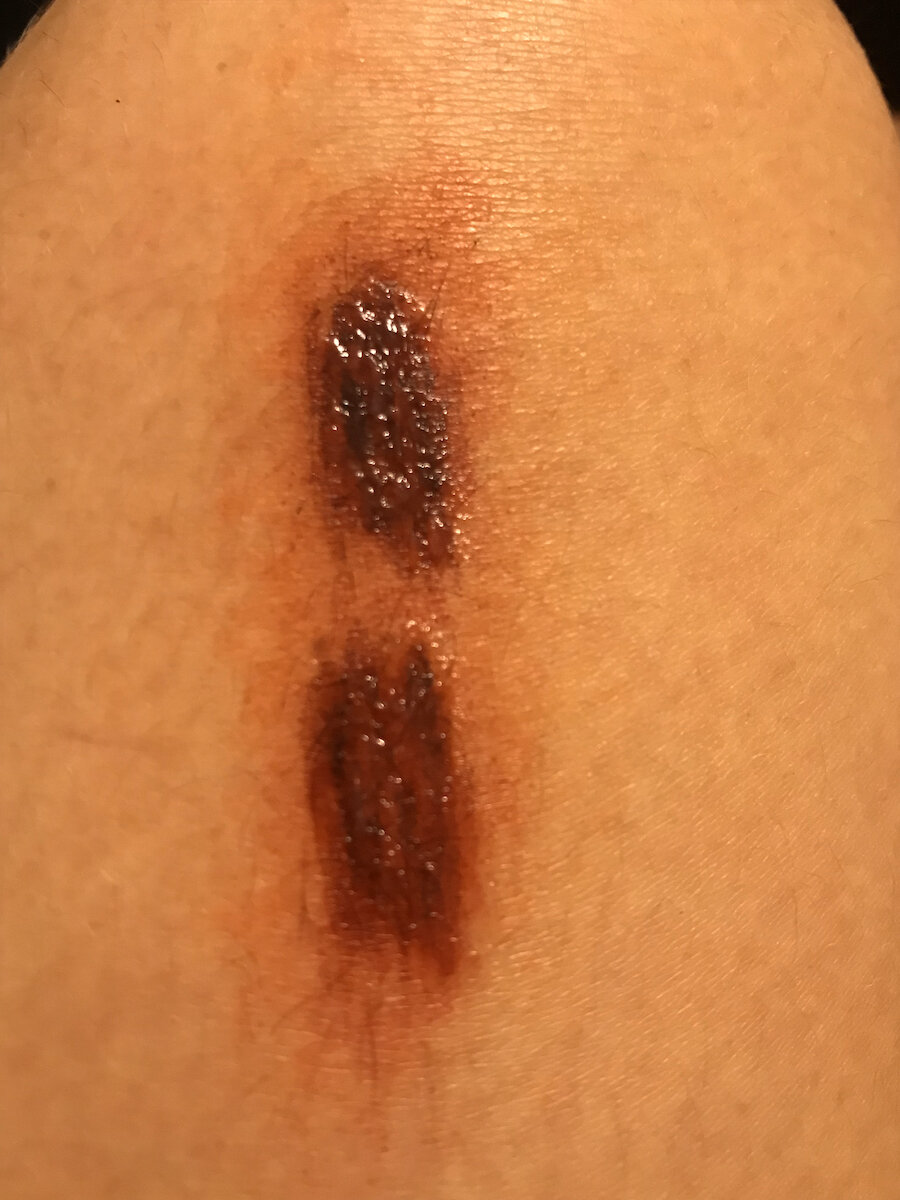 Bullet Graze