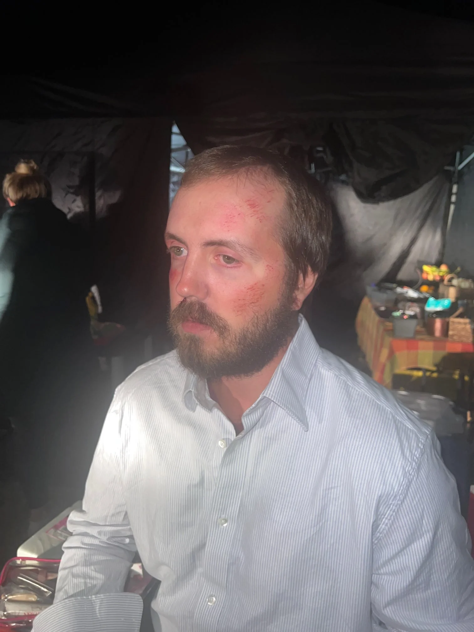 Punched in face (fresh)