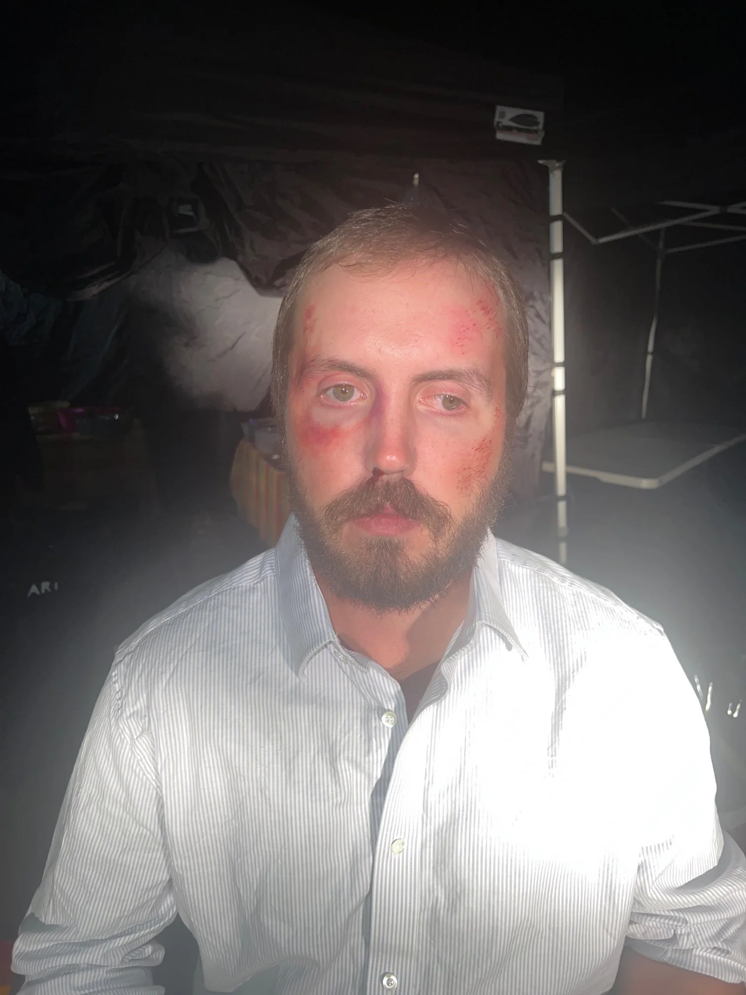 Punched in face (fresh)