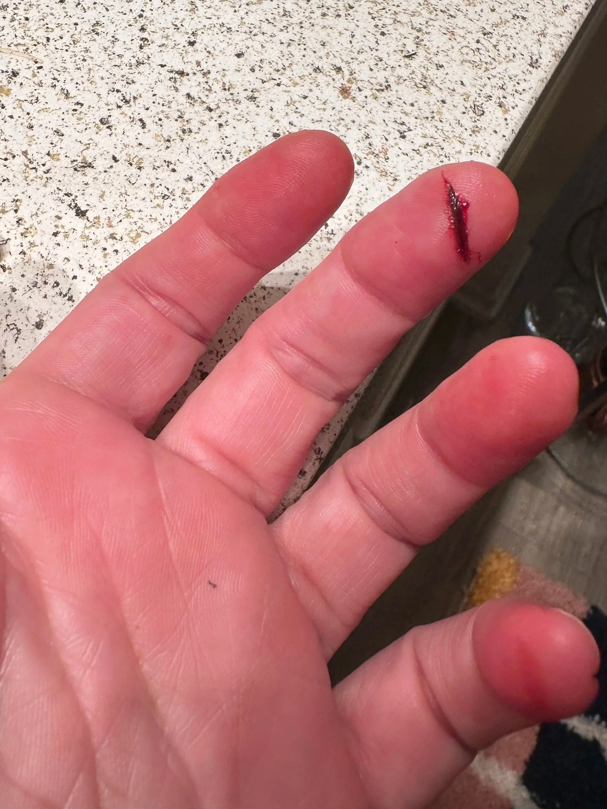 Small cut on tip of finger