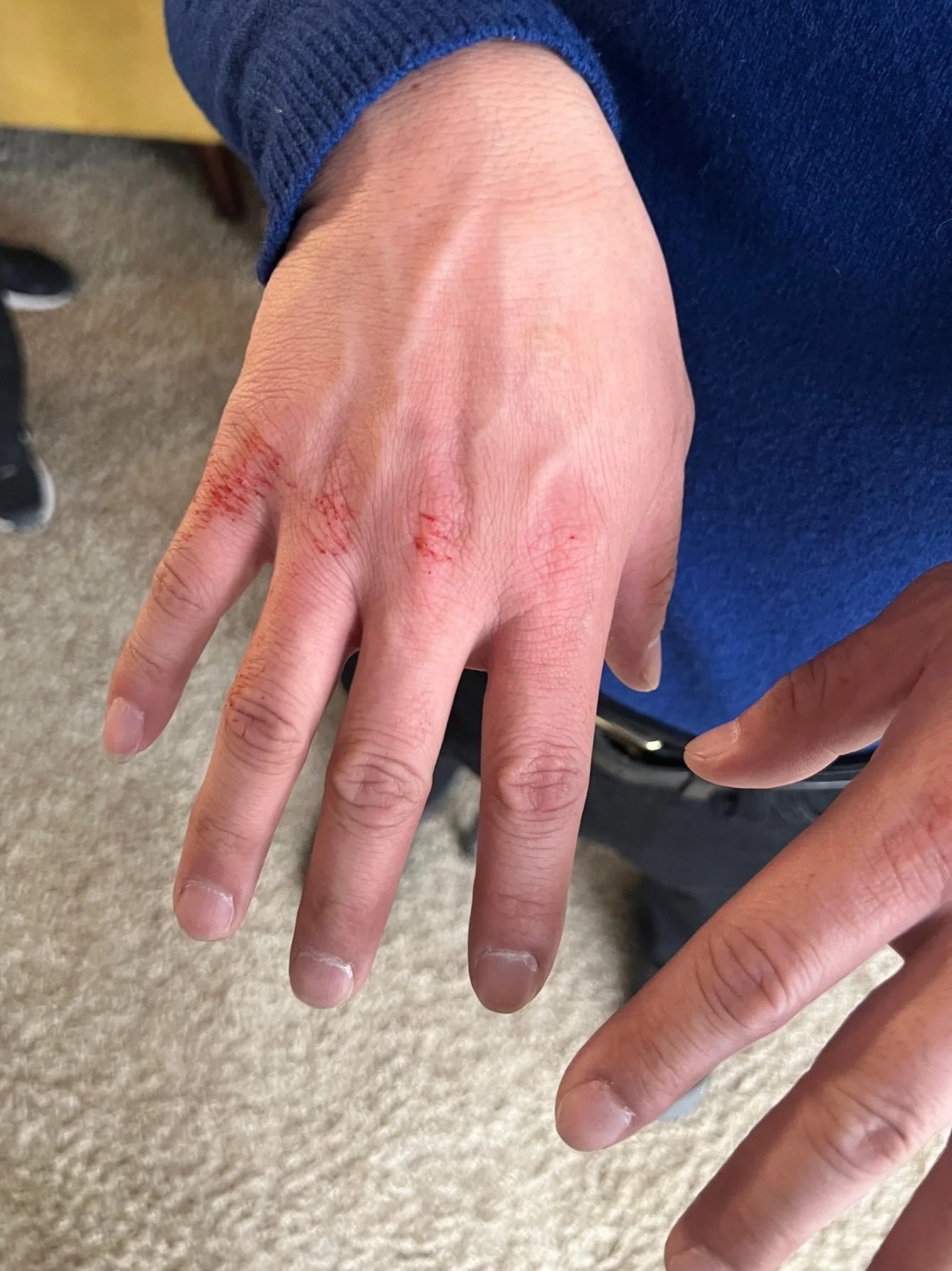 Fresh Scratch in A killer romance