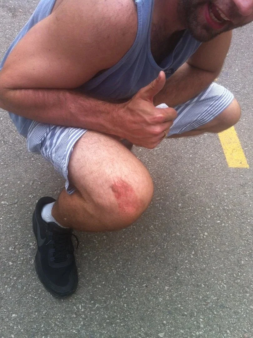 Knee scrape on Joe Stapleton for Pokerstars