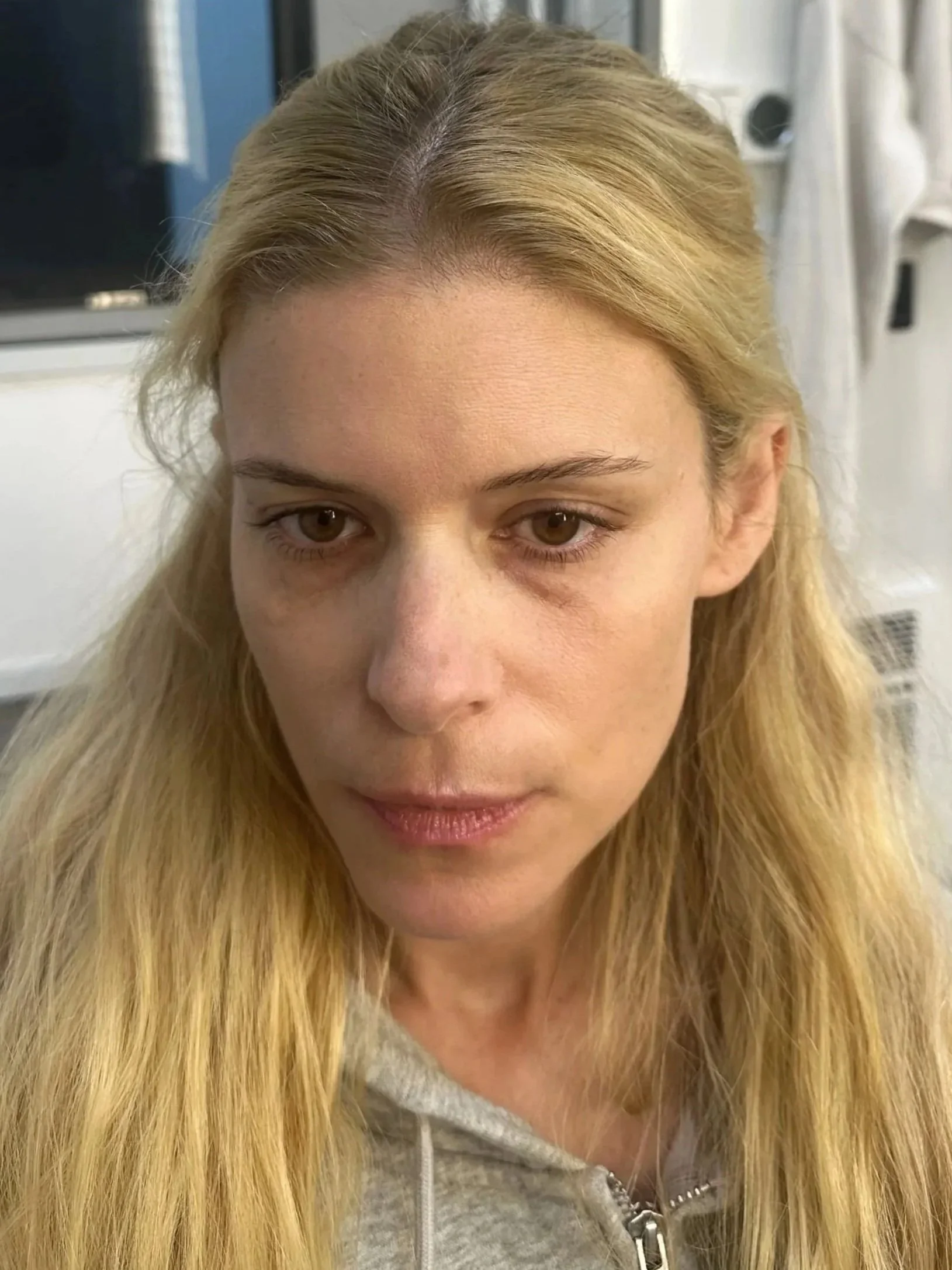 postpartum created on Kate Mara for Imperfect Women