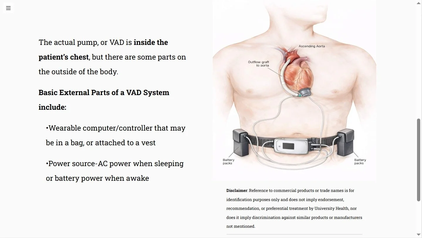 Ventricular Assist Device