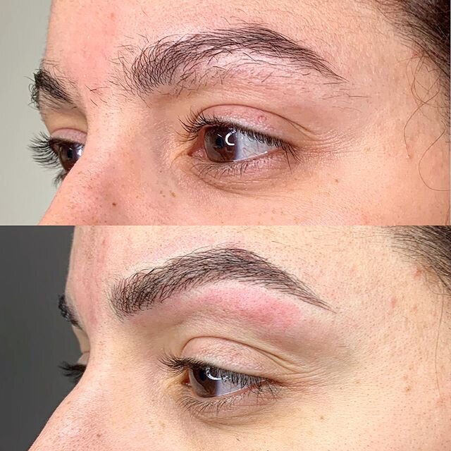 💖 Before &amp; After Microblading 💖