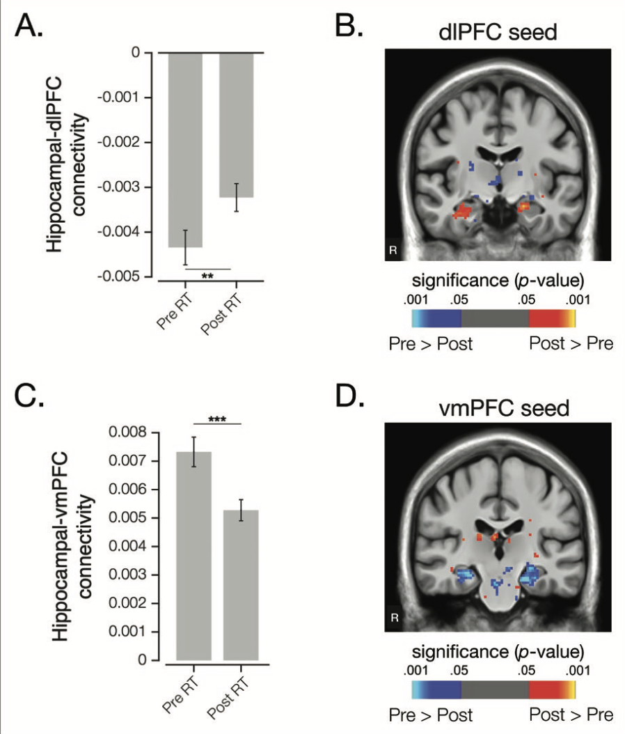 Candidate Targets for Resilience Training to Reduce Transdiagnostic Risk for Mental Illness