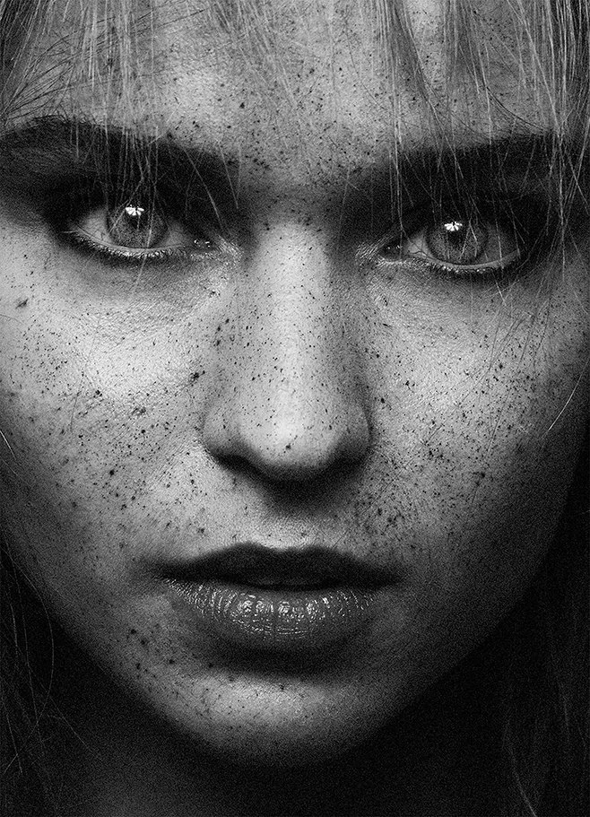 freckles-1.jpg