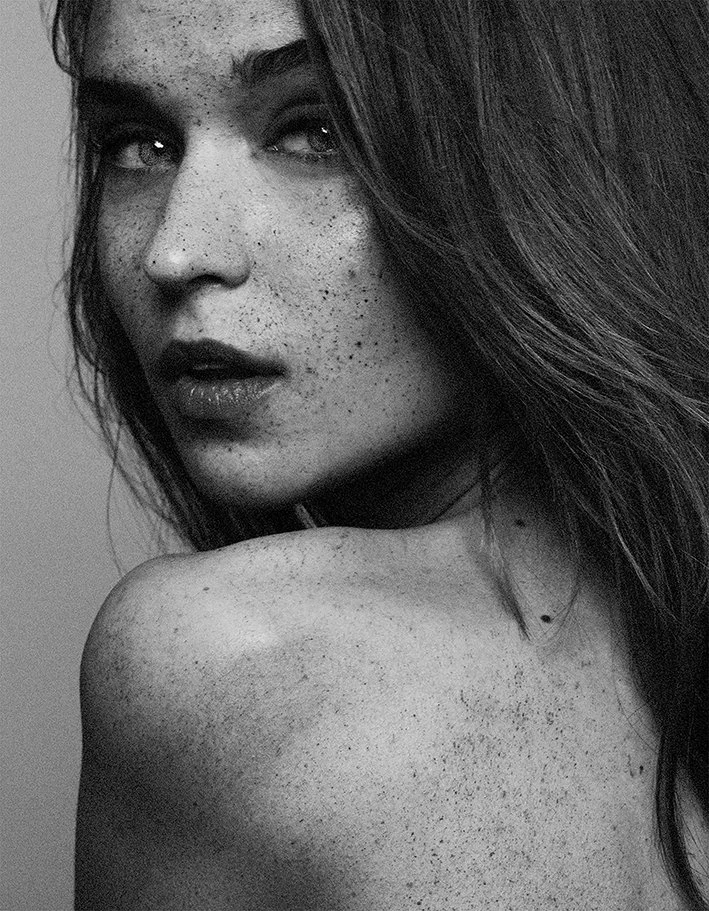 freckles-2.jpg