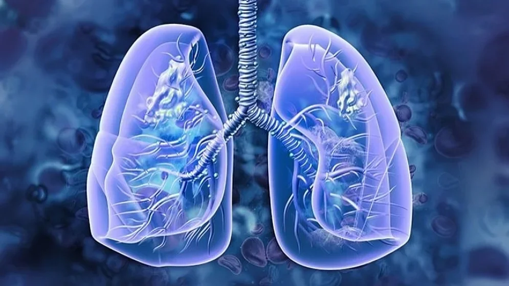 Case Study: Supporting the Body During Long-Term Lung Cancer Treatment