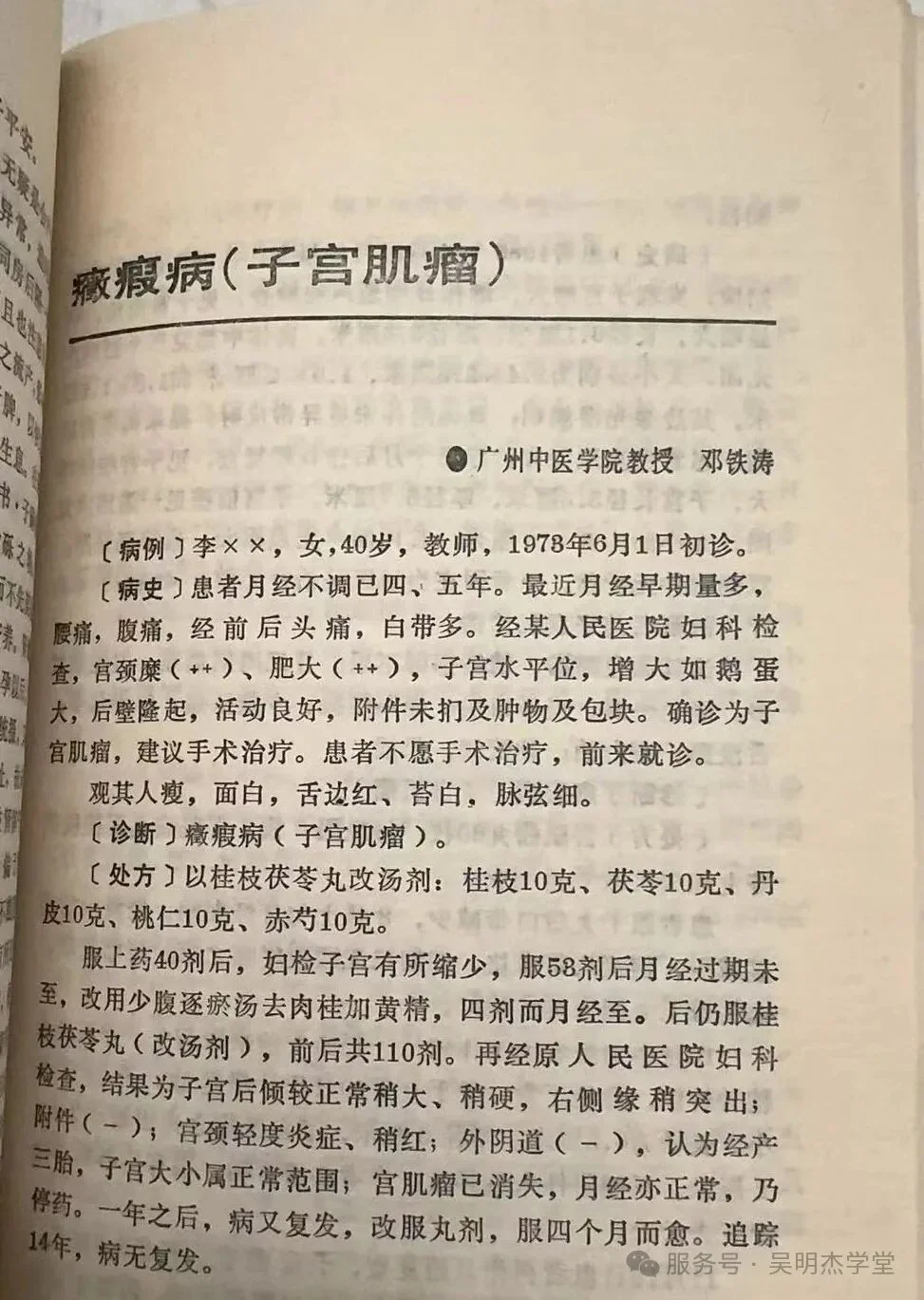 Zhengjia Disease (Uterine Fibroids)  — Professor Deng Tietao, Guangzhou College of Traditional Chinese Medicine
