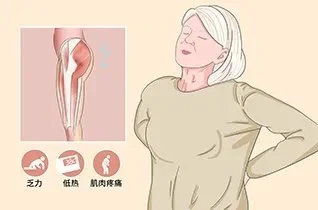 Manifestations of polymyalgia