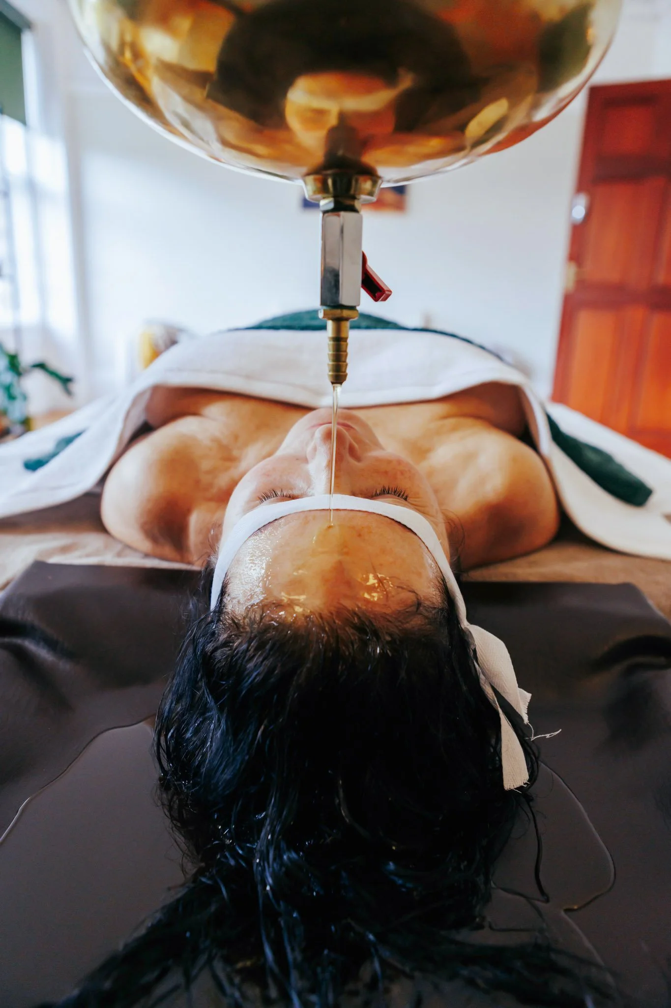 Shirodhara - OIL POURING ON FOREHEAD