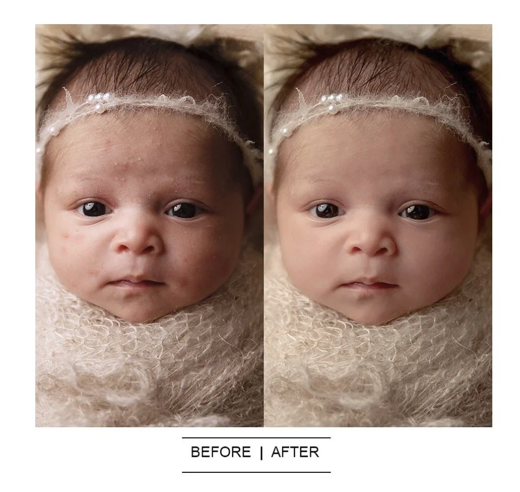 2 images of a baby with acne before and after editing