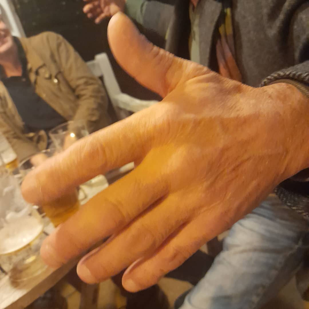 Look ar this man's hand.  Legend