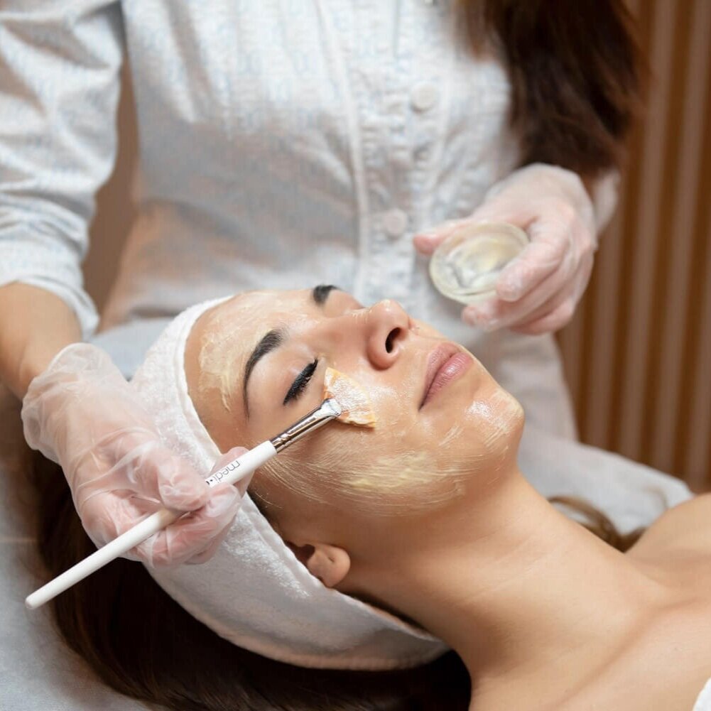 Chemical Peels