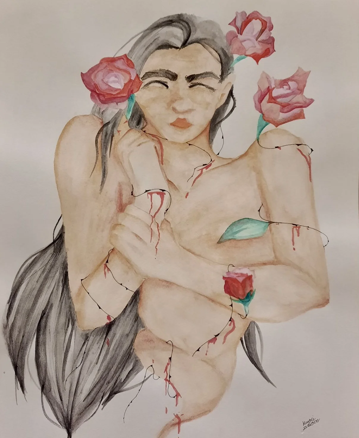 Mackenzie Iverson “Healing will Bloom”