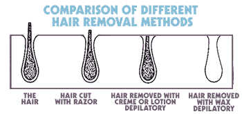 ways_to_remove_hair.gif