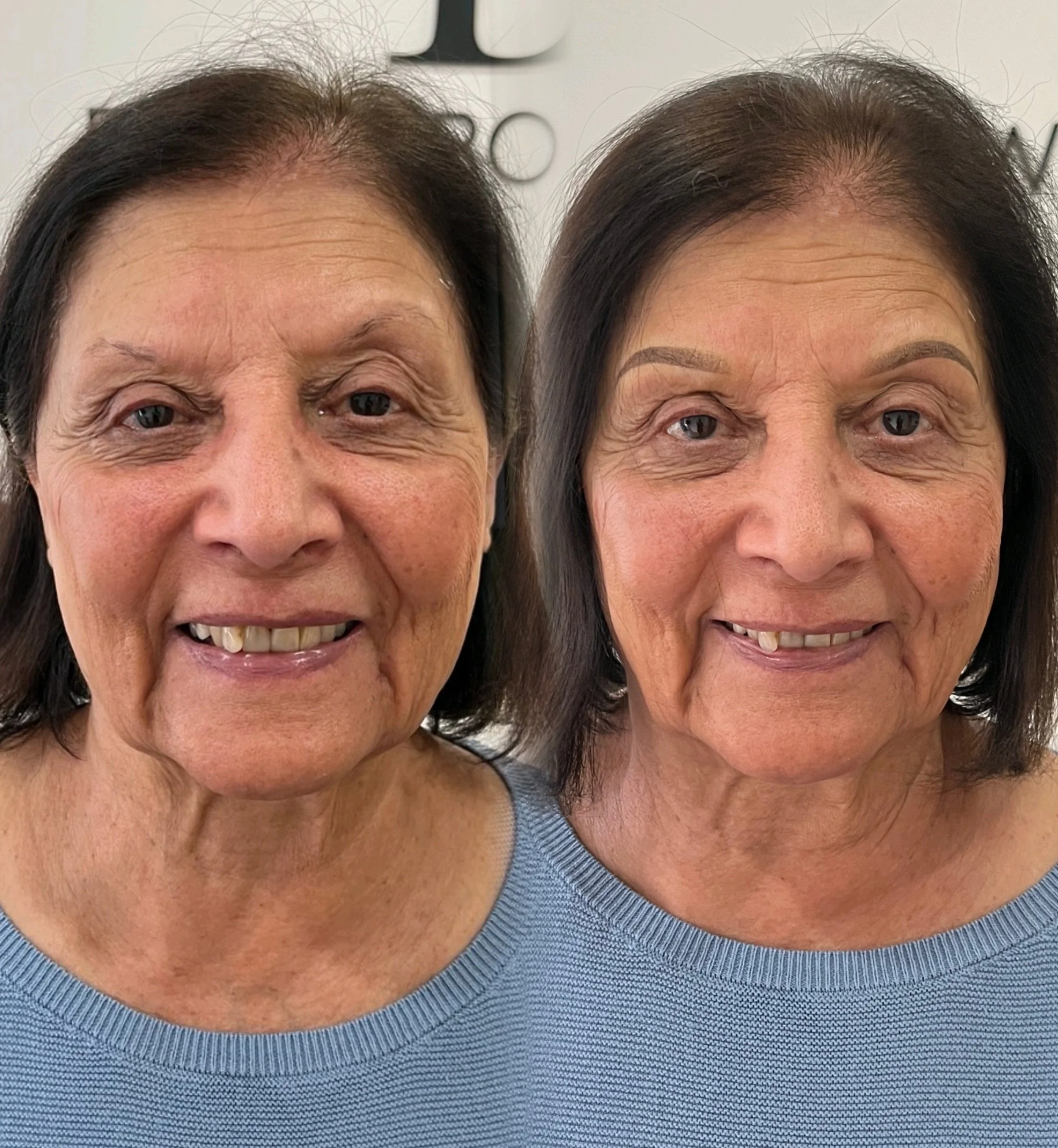 CAN YOU BELIEVE SHE IS 81?! 🤯😍

Mature brows have ALWAYS been a favourite of mine. Not only do they create some of the most beautiful before-and-afters, but the confidence they bring back to these incredible women is truly priceless. 🤍

One thing 