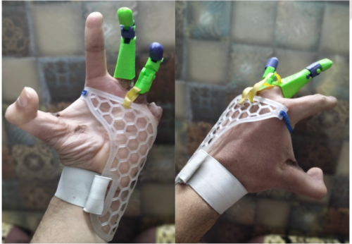 How I 3D Printed a Prosthetic Hand