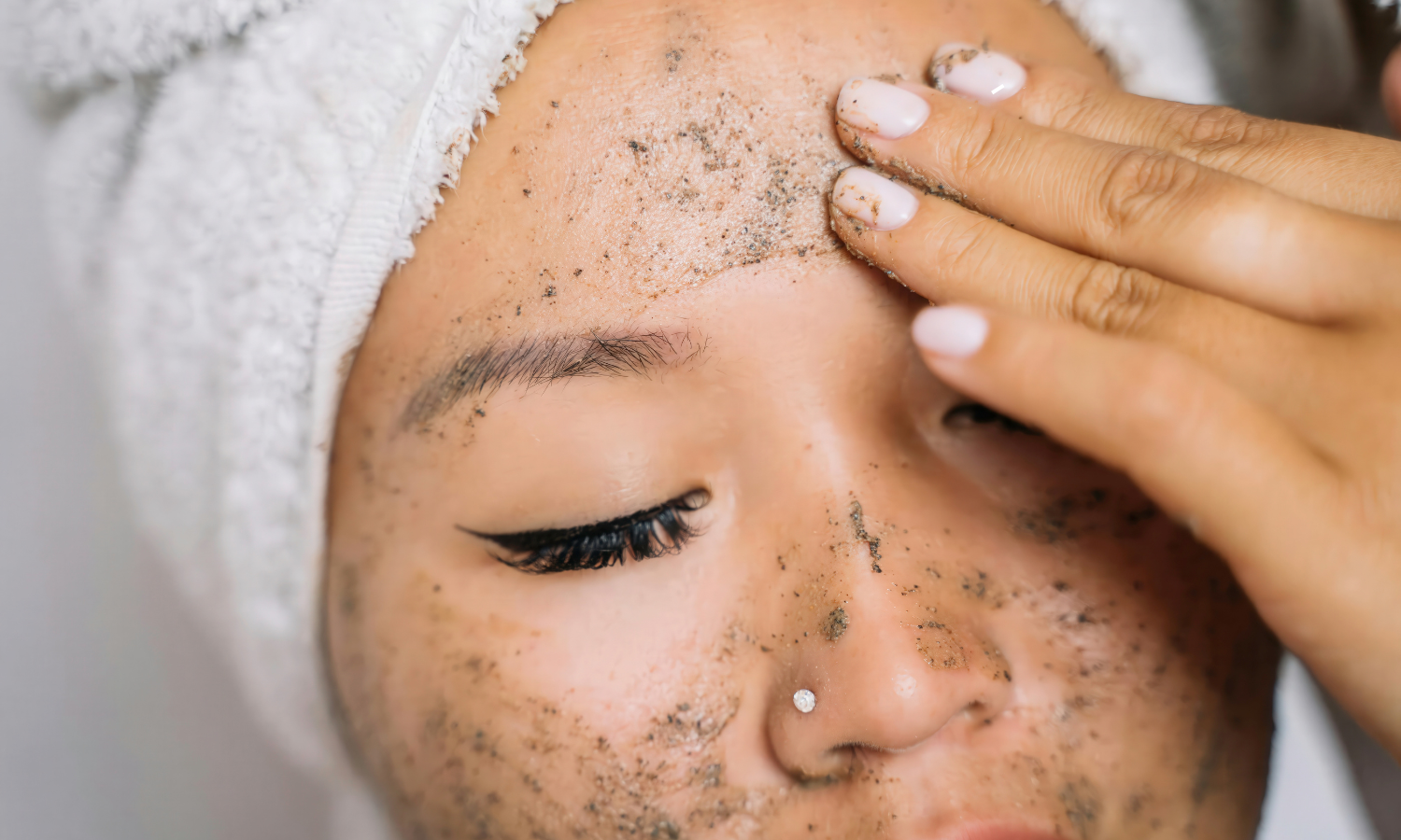 Chemical keratolytic products for psoriasis scale removal — urea salicylic acid Koebner phenomenon physical exfoliation contraindication
