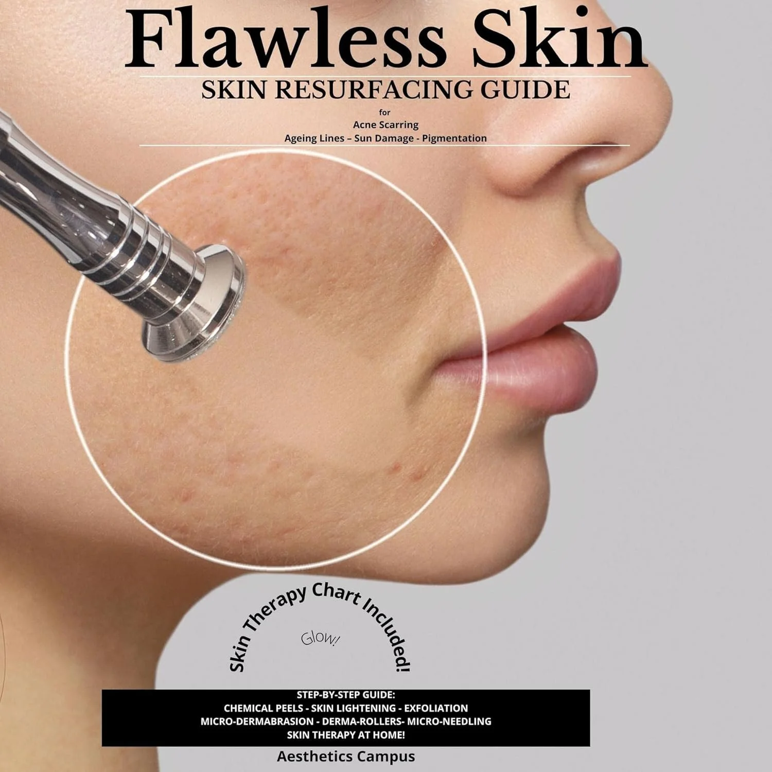 acne microdermabrasion scarring guide book