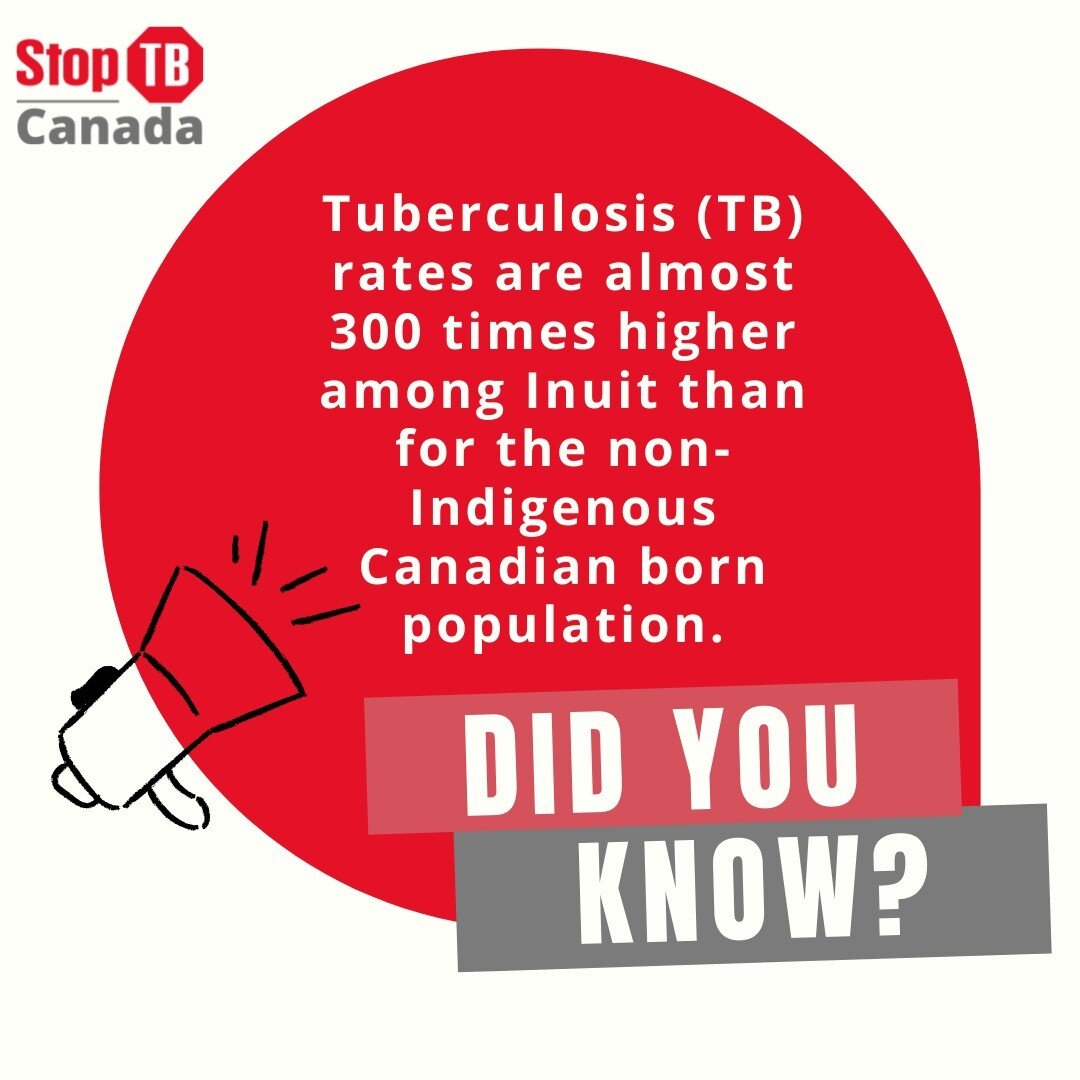 #TB rates are almost 300x higher in Inuit communities in Canada compared to non-Indigenous, Canadian-born populations. 

This is an example of a #TBinequity.