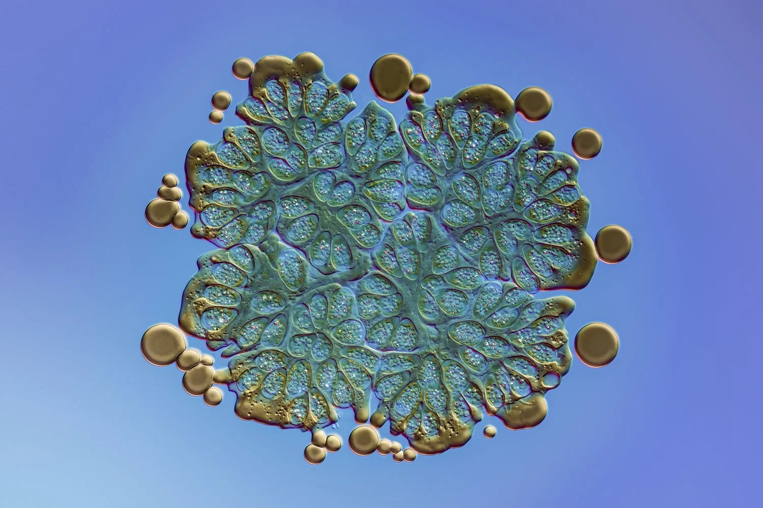 Light image of Botryococcus braunii secreting oil droplets (brown-ish droplets). Image credits Håkan Kvarnström Photography