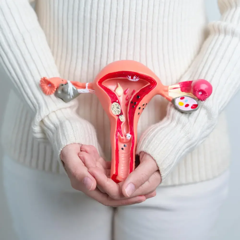 Woman holding a uterus model showing fibroids in front of her lower abdomen