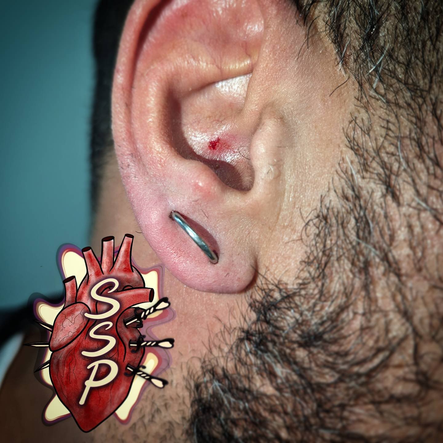 Such a badass idea for this guy's first piercing. Double Orbital Lobe Piercing.

If you're interested in coming in for a piercing. There is no appointment needed, you can just come into the shop while we are open. Any questions about piercings you ca