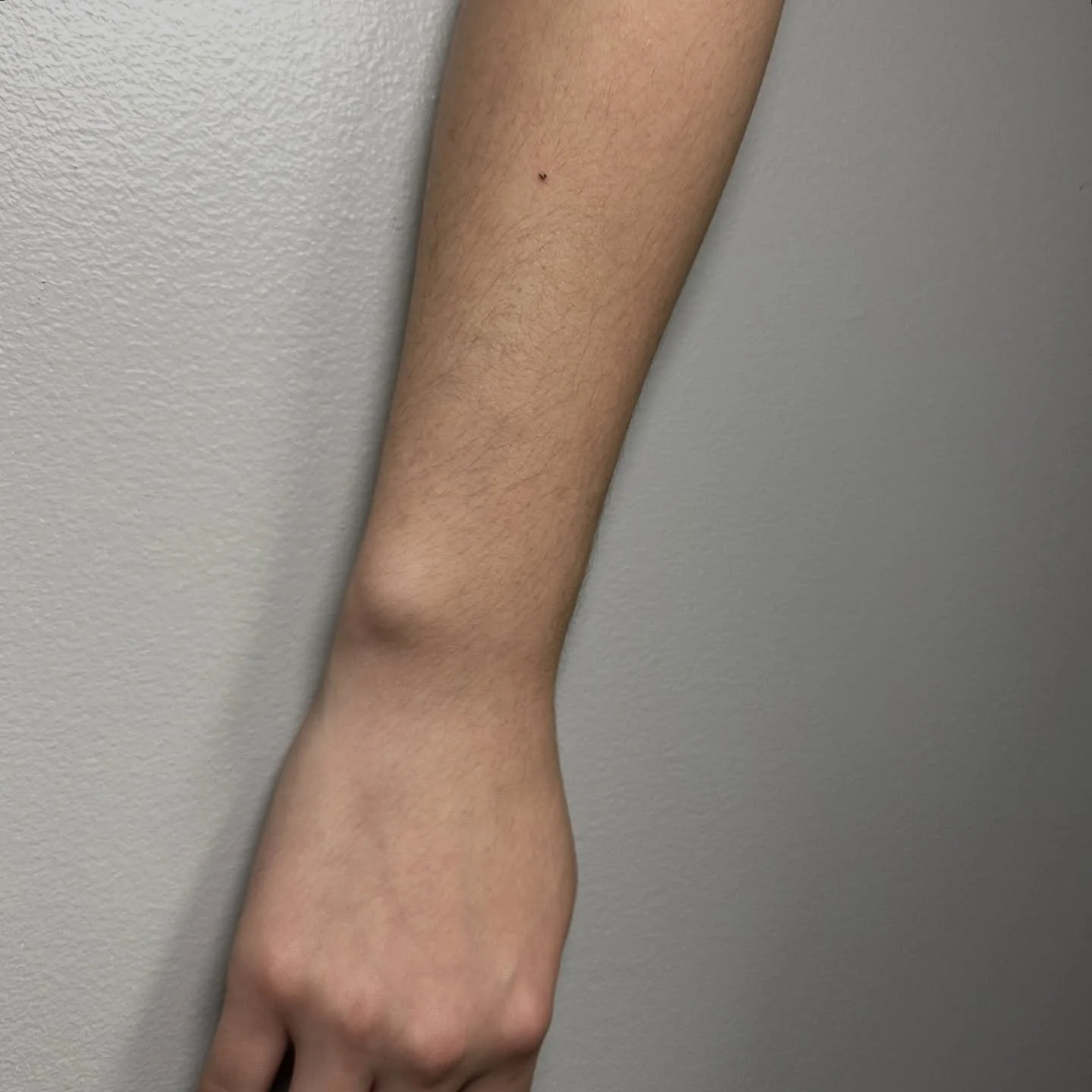 Heart Freckles 🧡🤏🏼