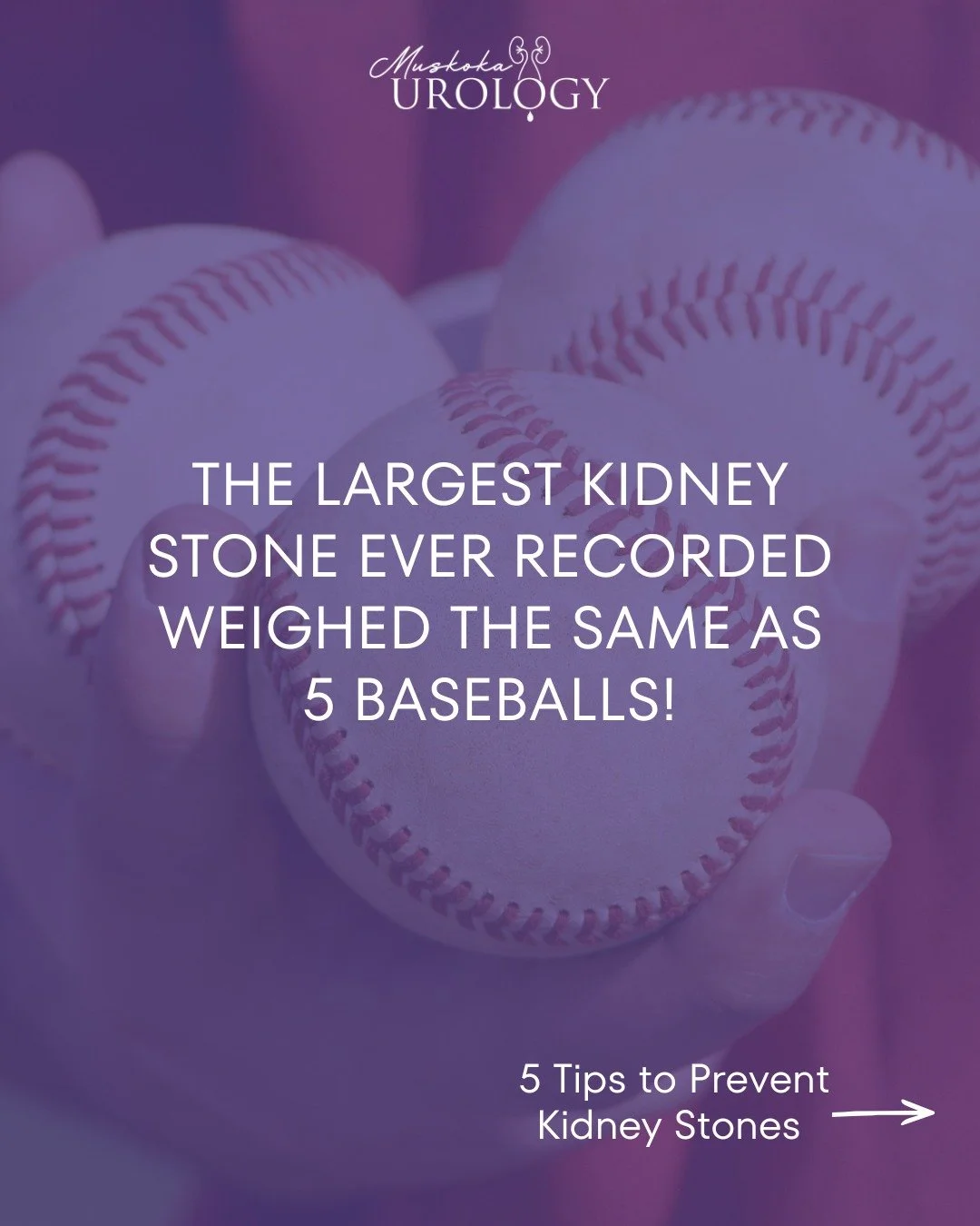 That&rsquo;s one &ldquo;ball&rdquo; game nobody wants to play! ⚾

Your kidneys are incredible filters-but they work best with plenty of hydration. Drinking enough water helps prevent minerals from piling up and forming stones in the first place. The 