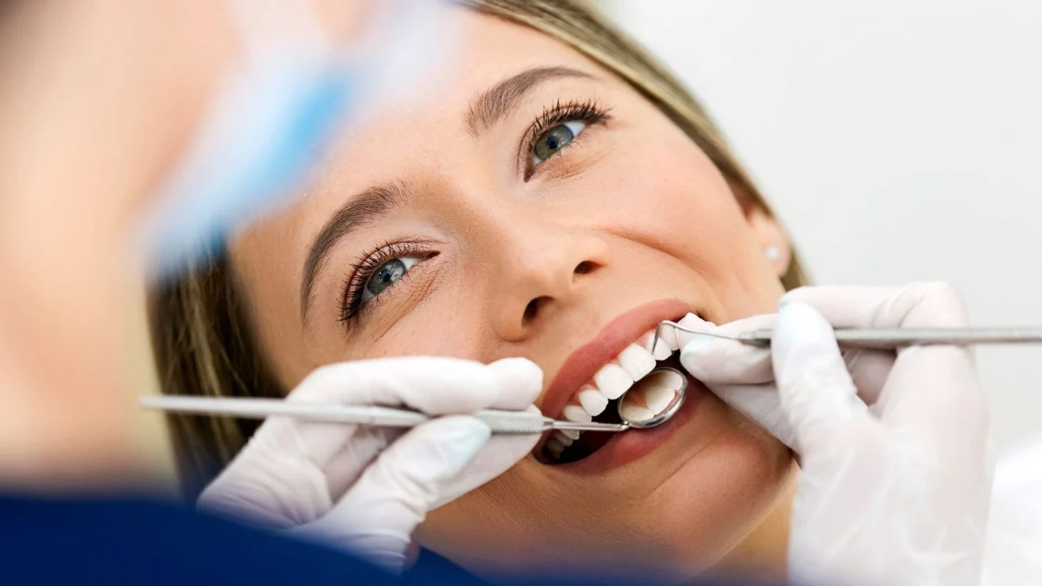 ELTHAM SMILES: HOW COMPOSITE BONDING CAN TRANSFORM YOUR LOOK
