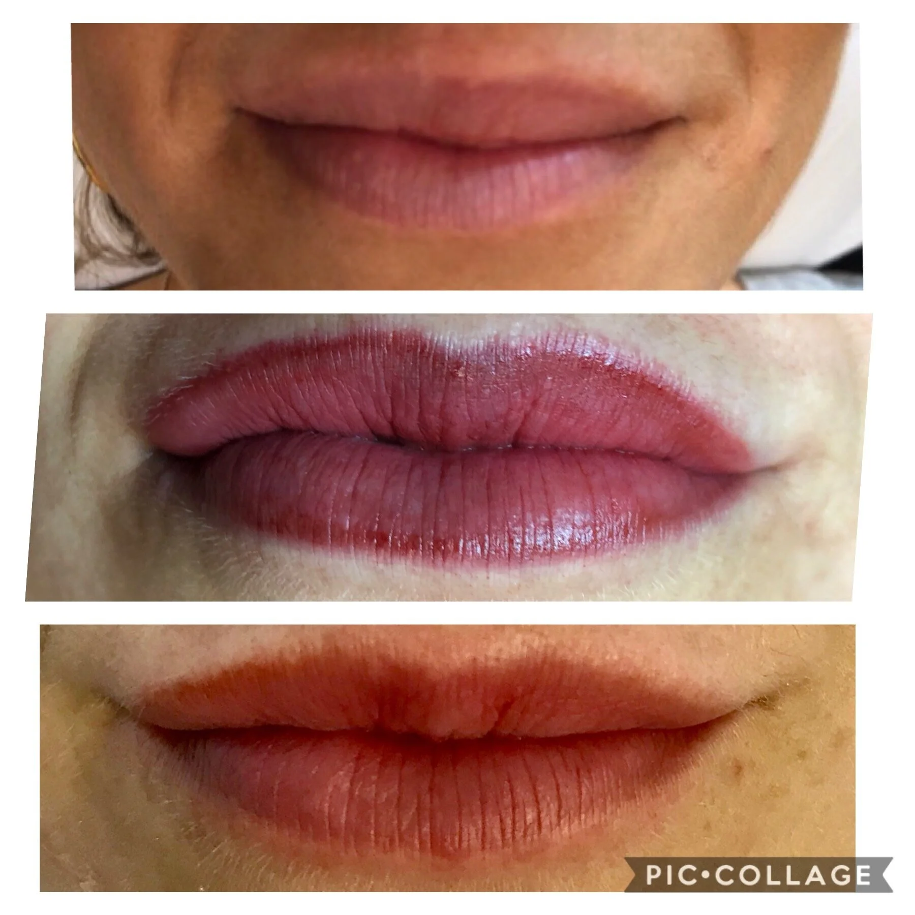 Lip Filler Permanent Color Add - Permanent Makeup Lips Before After Lip Filler Permanent Color Add - Permanent Makeup Lips Before After