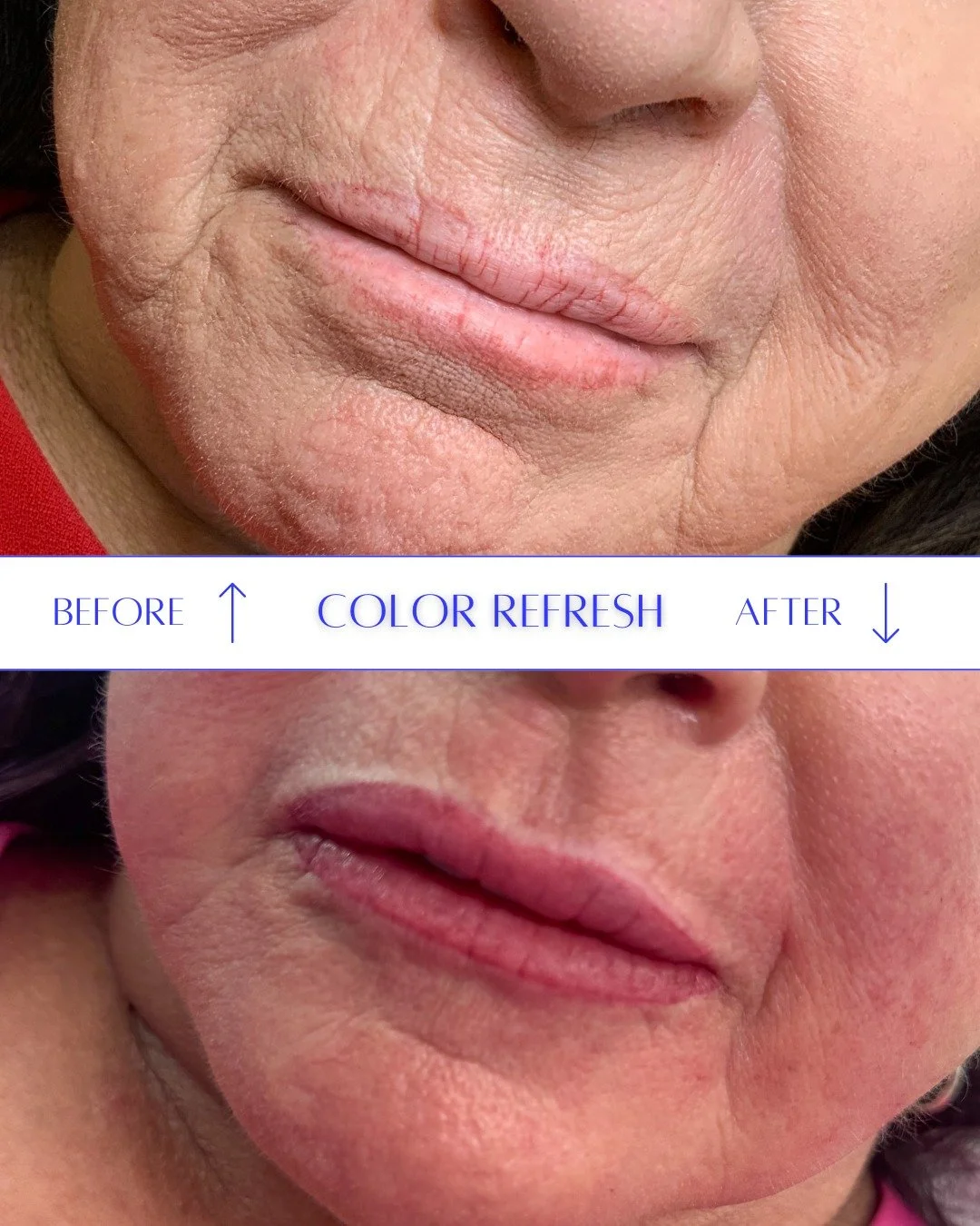 Is your permanent makeup in need of an update? A lot has changed in the world of permanent cosmetics!

Pigments are better, and techniques have evolved to be less traumatic on the skin, which means less swelling, scabbing, and recovery time.

While i
